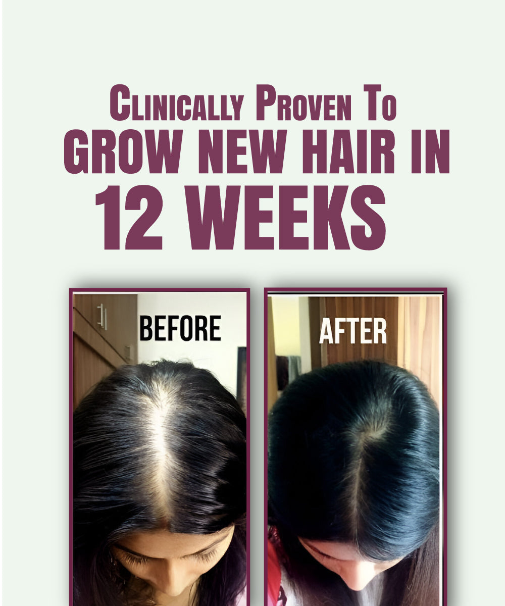 Umkash Organic Hair Oil by UmhashCo