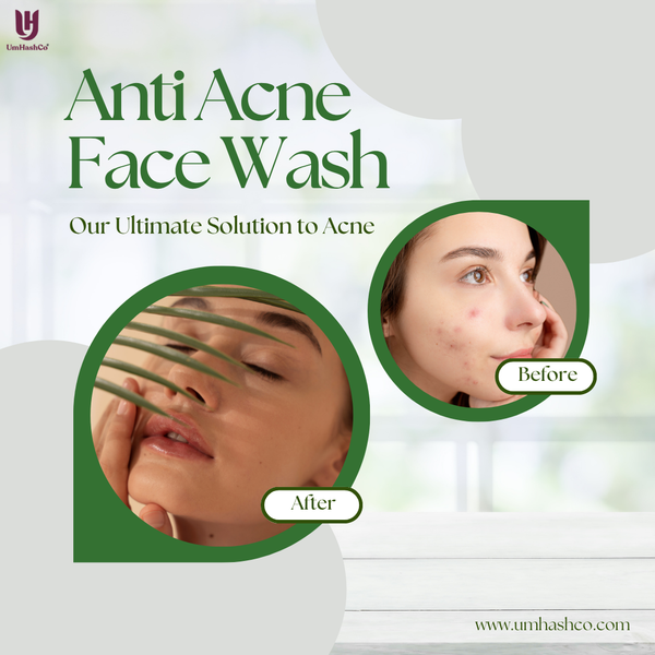 UmHashCo Anti Acne Face Wash before and after results — clear glowing skin from acne treatment for oily skin