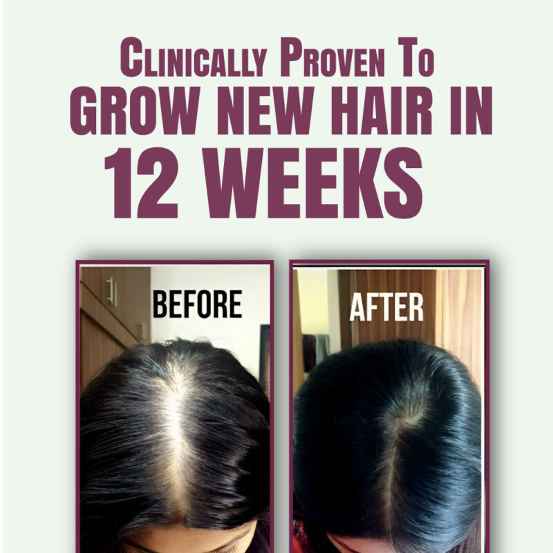 Umkash Organic Hair Growth Oil by Umhashco - Image 5